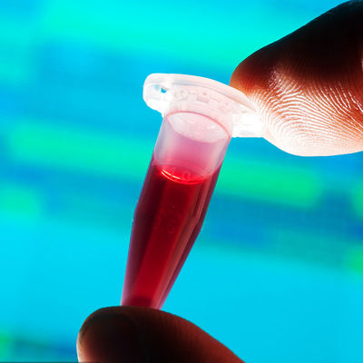 Servizio di autenticazione di terzi di prove dei laboratori di rilevazione dell'alimento del biberon rapido approvato dalla FDA del contatto