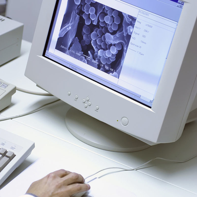 Servizi difficili elettrici elettronici per l'apparecchio portatile della televisione
